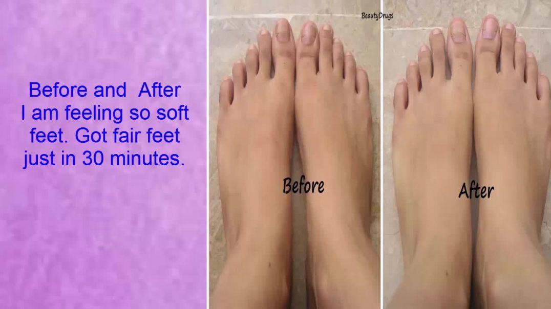 ⁣Feet Whitening Pedicure - Skin Whitening For Black Skin