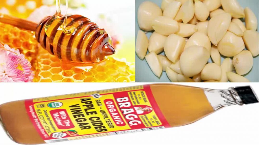 Garlic, Apple Cider Vinegar And Honey – Combination That Treats Many Diseases