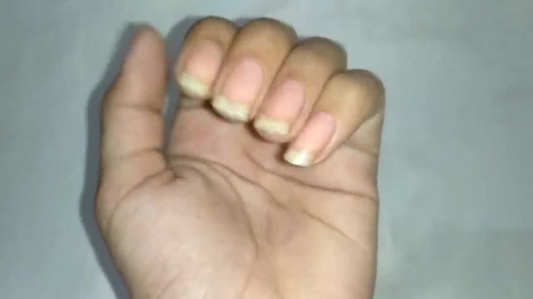 ⁣Grow Nails just in 3 Days [ Faster Growth ] _ How to Grow Nails Fast __ Faster Nail Growth Remedy __