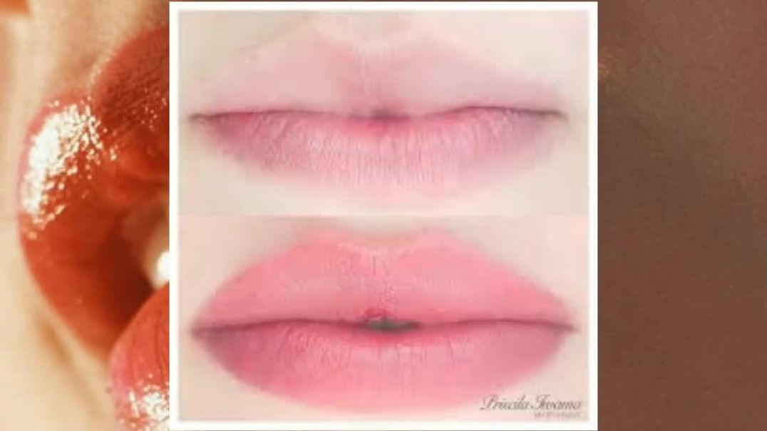 ⁣Soft Netural Pink lips Remedy _